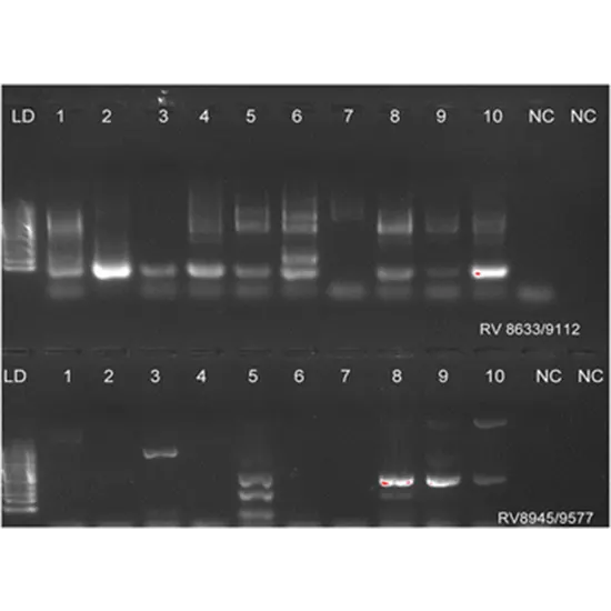 Rubella DNA PCR - Quantitative
